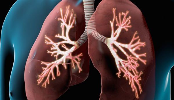 bệnh viêm phế quản phổi