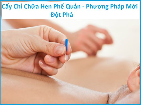 Cấy chỉ chữa hen phế quản - phương pháp mới đột phá!