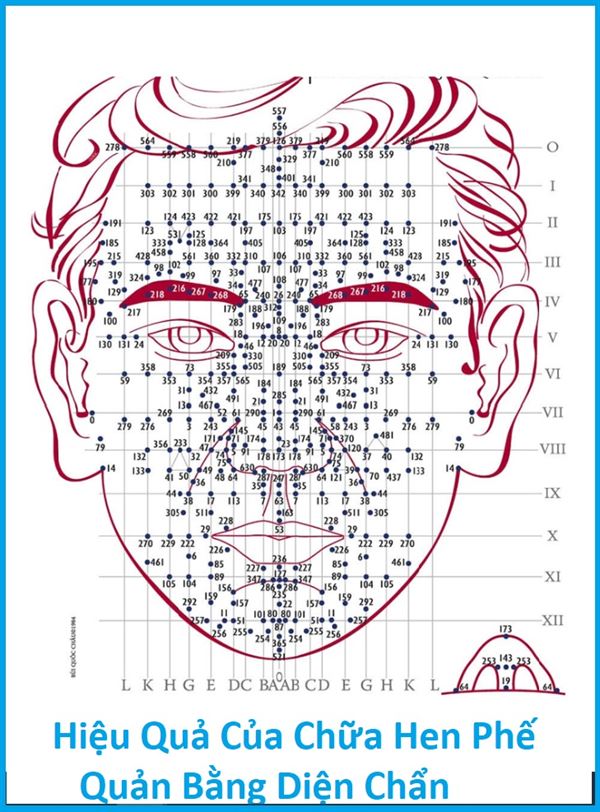 Hiệu Quả Của Chữa Hen Phế Quản Bằng Diện Chẩn