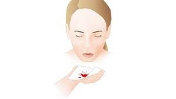 Khạc đờm ra máu vào buổi sáng