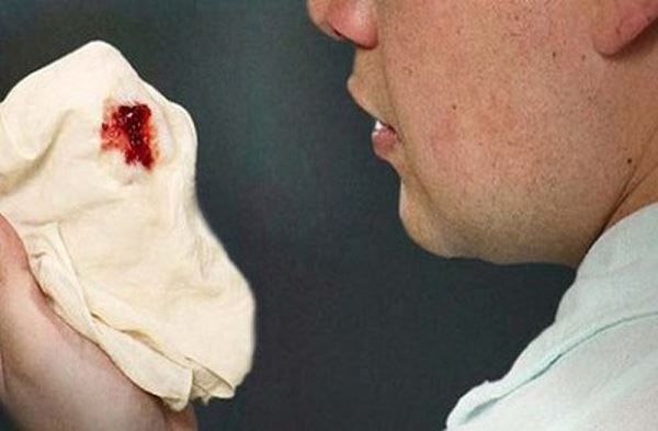 Khạc đờm ra máu