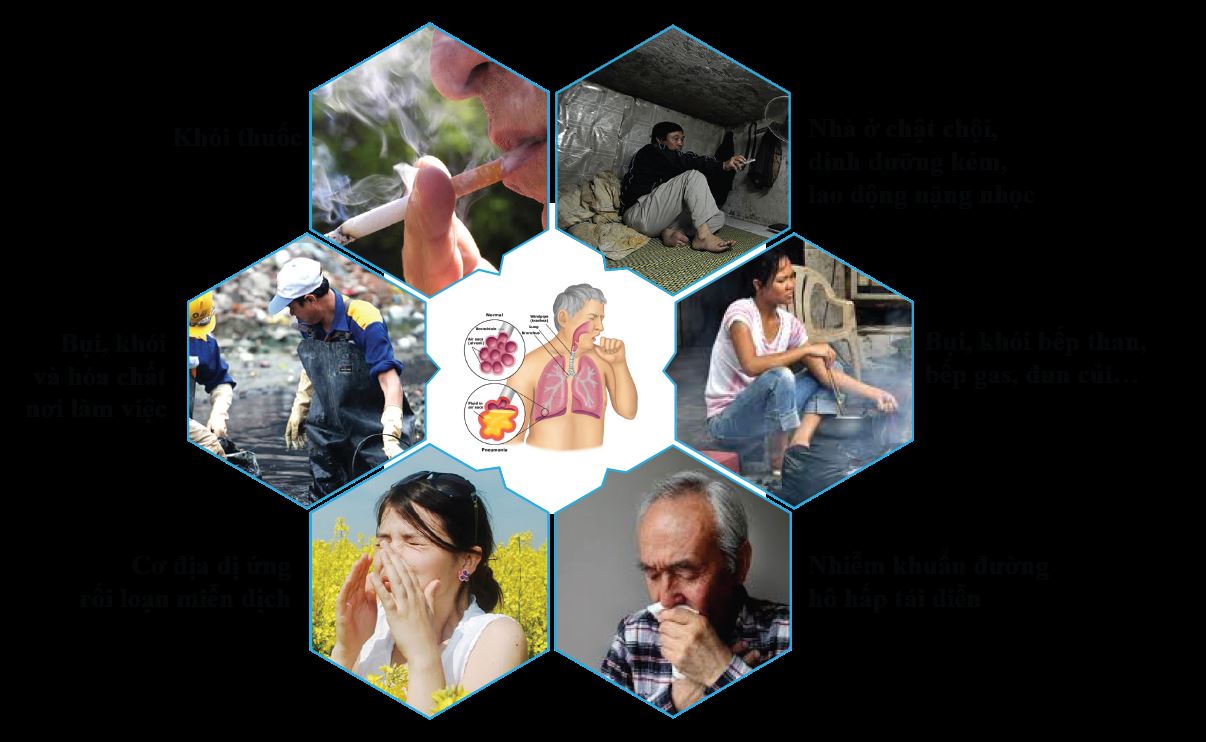 nguyen-nhan-gay-copd