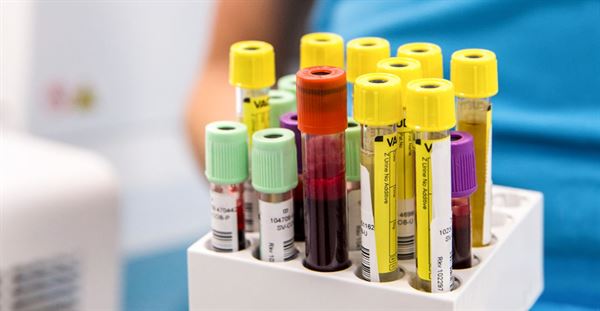 Công thức máu có thay đổi mạnh mẽ khi mắc phải viêm phế quản cấp