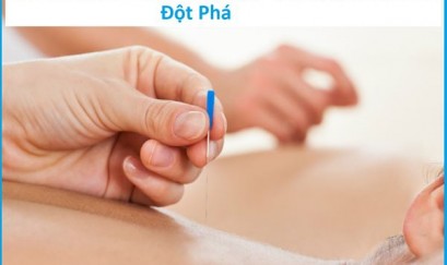 Cấy chỉ chữa hen phế quản – Phương pháp điều trị không dùng thuốc