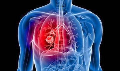 Ho đau tức ngực là biểu hiện của bệnh gì?