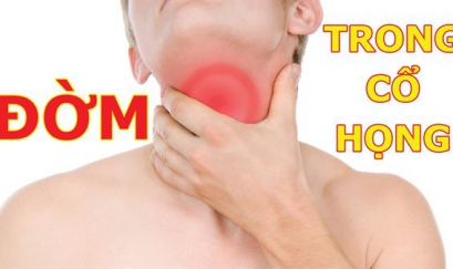 Cách trị ho có đờm ở cổ họng lâu ngày không khỏi